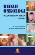 Bedah  Onkologi Diagnosis dan Terapi