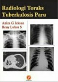 Radiologi Toraks Tuberkulosis Paru