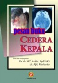 Cedera Kepala